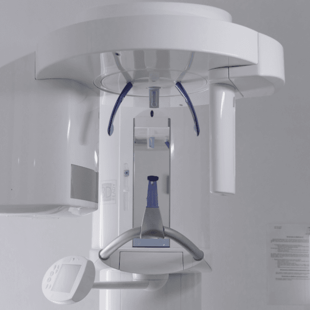 Panoramic Dental X-Rays